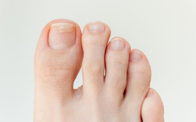 Kako prepoznati nedostatak vitamina u tijelu